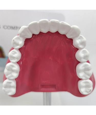 Upikit Dental Model for Sick Teeth - Compare Smoking vs Normal Teeth | Ideal for Medical Demonstrations - Buy Online on GoSupps.com