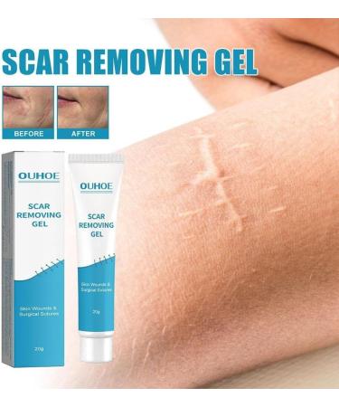 Waitlover Scar Removal Cream Gel - 20g | Repairs Pock Marks, Burns, Surgical Scars, Cesarean Scars & Stretch Marks | Moisturizes & Smoothens Skin - Care Mark Treatment - Buy Online on GoSupps.com