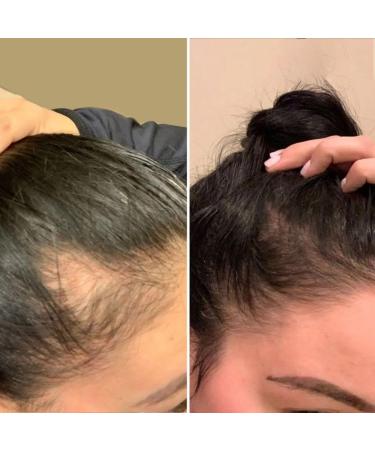  Rossen Rossen Hair Infusion Set Hair Loss Treatment Promotes Growth with Argan Oil and Ginger 4 in 1 Formula with Natural Ingredients Strengthens and Nourishes - Buy Online on GoSupps.com