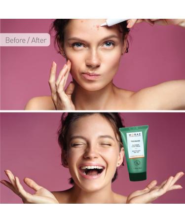 Moraz Polygonum Teenage Facial Cream - Oil-Free Moisturizer for Oily Skin | Lightweight Mattifying Face Cream 1.7 oz - Shop Now Globally - Buy Online on GoSupps.com