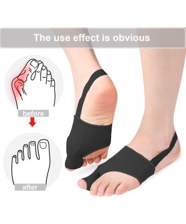 Bunion Corrector for Women and Men - Orthopedic Bunion Splint for Hallux Valgus Relief - Toe Separator for Bunion Relief - Day/Night Comfort - Black - Buy Online on GoSupps.com