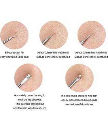 Blackhead Remover Pimple Extractor Tool Acne Kit - Blemish Treatment for Nose & Face Skin - Buy Online on GoSupps.com
