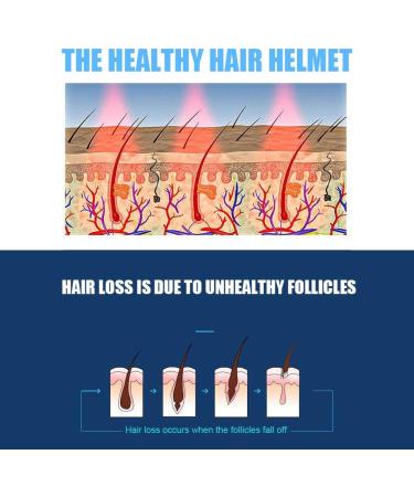 Hair Growth Helmet Device Anti Hair Loss Promote Hair Growth Hair Growth Helmet Beautymisc & Cap System Hair Growth For For Men And Women Device(Black-Uk) - Buy Online on GoSupps.com