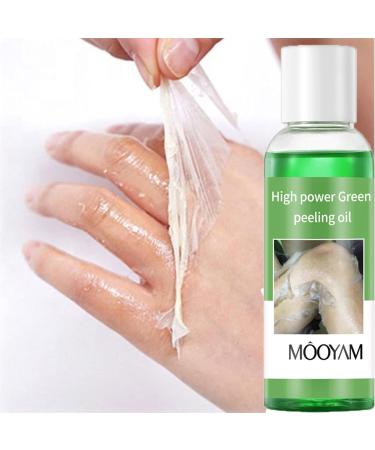 Extra Strength Peeling Oil for Dark Skin - 110ML | Chemical Peel for Face Hands & Feet - At Home Treatment - Buy Online on GoSupps.com