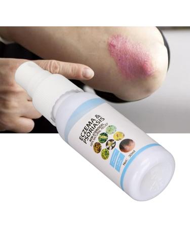 Travel-size Itching Relief Spray 30ml - Natural Skin Immunity Support - Buy Online on GoSupps.com