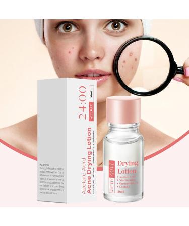 Spot Lotion 10 ml Drying Solution for Spots and Moisturizers | Fast-Acting Liquid for Facial Blemishes for Women for Daily and Nighttime Use Travel and - Buy Online on GoSupps.com