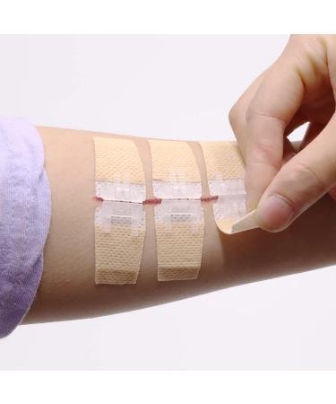 Longmed Emergency Wound Closures - Butterfly Adhesive Bandages - 3 Pieces - Buy Online on GoSupps.com