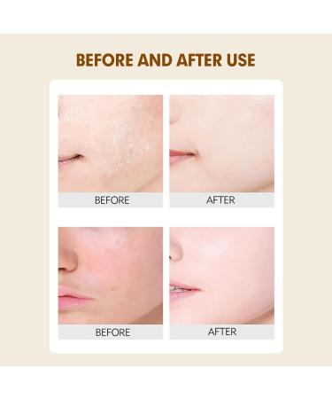 2PCS Rice Exfoliating Ampoule Set Black & White Rice Exfoliating Essence Even Skin Tone Gently Exfoliates Minimizes Pores Deeply Moisturizes and Creates Radiant Skin. - Buy Online on GoSupps.com