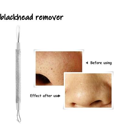 Blackhead Remover Tool Professional Black Head Remover Tool Skincare Spot Treatment Whitehead Remover for Blemish Comedone Whiteheads Pimple Popper with Double Sided Soft Touch and Anti-Slip Design - Buy Online on GoSupps.com