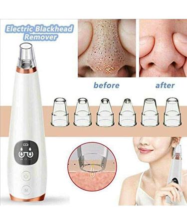 SMSOM Blackhead Remover Vacuum Portable Electric BlackheadRemoval Tools Pore Cleaner Extractor Facial Cleaner 6 Replacement Probes USB Rechargeable (Black) - Buy Online on GoSupps.com