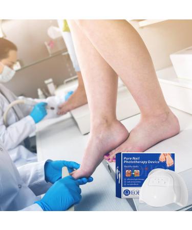 Hovceh Nail Fungus Treatment Device | Light Therapy for Toes & Fingers | Effective Nail Fungus Cure - Buy Online on GoSupps.com