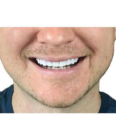 Instant Smile Flex 2pk - Bright White Shade - One Size Fits Most - Easy At-Home Fix for a Perfect Smile! - Buy Online on GoSupps.com