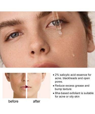 |Most Gifted| 2024 New 3PCS 30 Days Advanced Collagen Boost Anti-Aging Botox Face Serum - Facial Serum Anti Aging - Anti Aging Serum - Collagen Boost Anti Aging Serum - 30ml * 3 - Buy Online on GoSupps.com