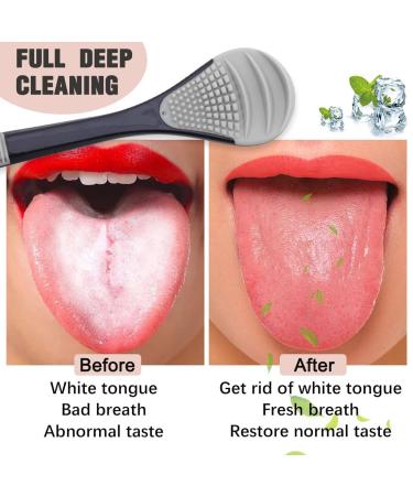 KSJEHW Tongue Scraper Set - 2 Medical-Quality Tongue Cleaning Tools for Fresh Breath & Bad Breath Relief - Buy Online on GoSupps.com