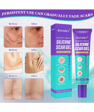  HASAIKA Scar gel cream for new and old scars smooth and hydrated skin 40 g - Buy Online on GoSupps.com