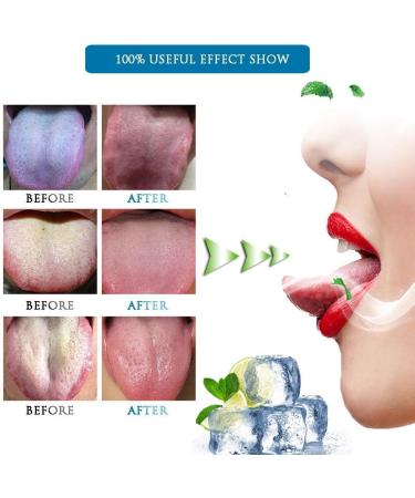 Pure Copper Tongue Scrapers | Eliminate Bad Breath & Toxins Effectively - Buy Online on GoSupps.com