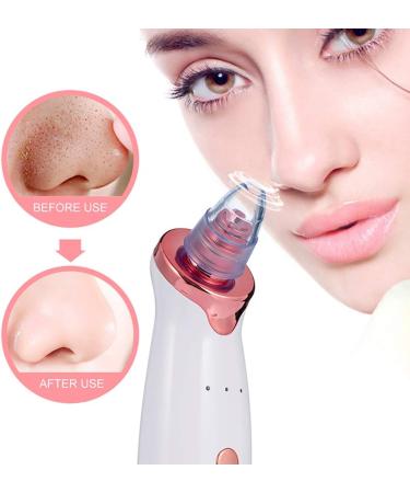 Blackhead Remover Tool Pore Vacuum Black Head Acne Treatment Remover Electric Face Skincare Cleaner Tools - Buy Online on GoSupps.com