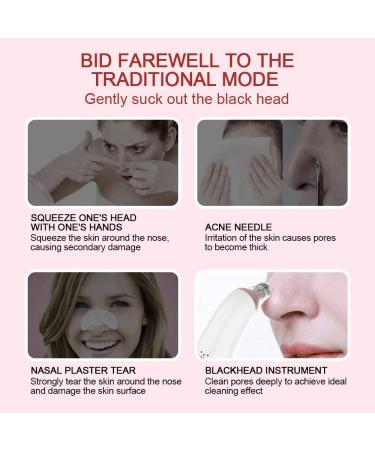 TTB1 Electric Facial Blackhead Remover Kit | USB Rechargeable | 3 Adjustable Suction Cups | Deep Facial Cleaning | Rose Gold - Buy Online on GoSupps.com