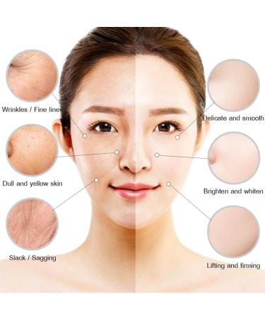 Angoily Cream Anti-wrinkle Face Lotion Dry Skin Moisturizer Gel Moisturizer Face Moisturizer Body Lotion Dryness - Buy Online on GoSupps.com