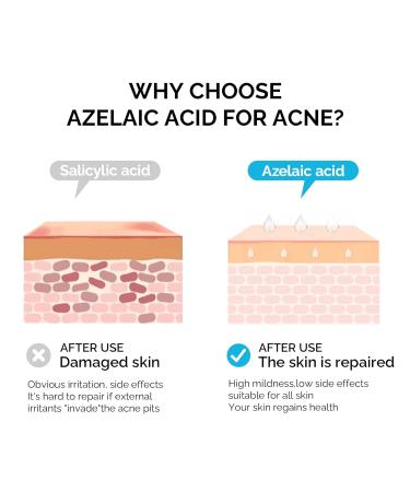 ZealSea Anti-Acne Face Sheet Mask 5 Pack - Sensitive Skin Care for Soothing, Cleansing, and Moisturizing - Brightening & Firming Beauty Mask for All Skin Types - 0.98 Fl Oz (Pack of 5) - Buy Online on GoSupps.com