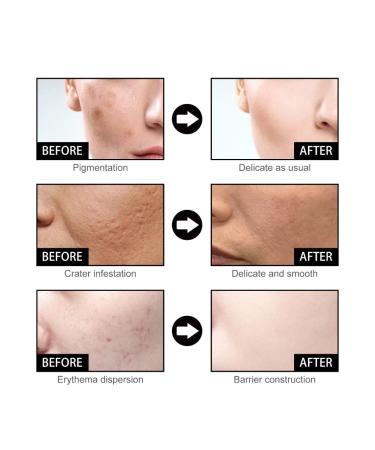 2pcs Nourishing Face Serum Shrinking Pores Brightening Skin Rejuvenation Eye Bags Removing Dark Circles Moisturizing Facial Essence - Buy Online on GoSupps.com