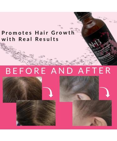 N+B Hair Growth Serum 2oz - Promotes Thicker, Fuller & Healthier Hair with Biotin | Natural-Based Formula to Prevent Hair Loss & Thinning in Women | All Hair Types - Buy Online on GoSupps.com