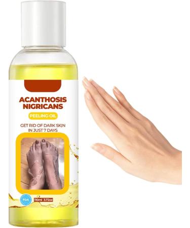  JPSDOWS Extra Yellow Peeling Oil Extra Strong Natural Spots Whiten for Dark Skin Whiten Yellow Peeling Oil for Exfoliates Improves Dullness Hyperpigmentation Evens Out - Buy Online on GoSupps.com