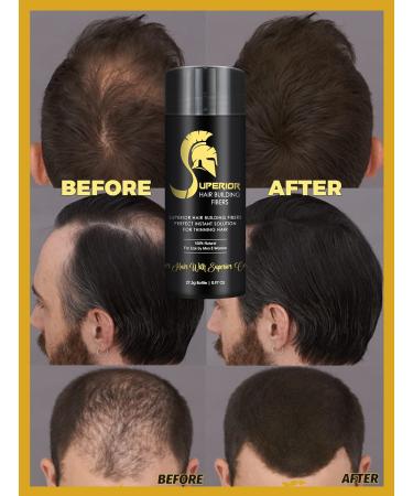 Natural Keratin Hair Fibers for Thinning Hair - Dark Brown 27.5g - Hair Loss Concealer for Men & Women - Buy Online on GoSupps.com