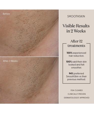SmoothSkin Pure Adapt Champagne IPL Hair Removal Device | Long-Lasting Hair Reduction for Women & Men | Home Use for Body & Face - Buy Online on GoSupps.com