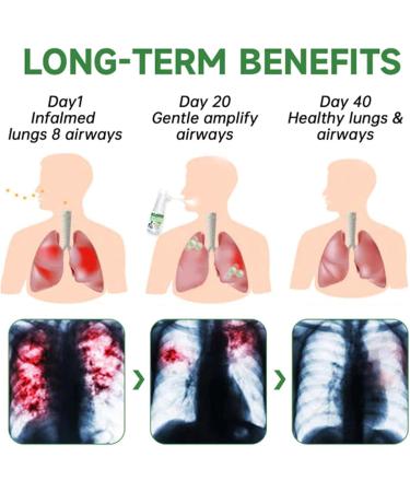 Lovilds Herbal Cleaning & Repair Spray - Lung Cleansing Solution | Furzero Respiclean 3PCs - International Shipping Available - Buy Online on GoSupps.com