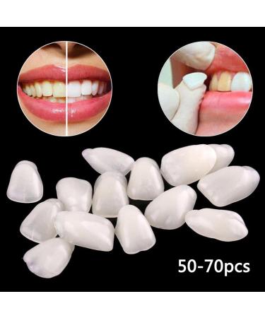 Facettes temporaires ultra-minces en r sine blanchissant de type mixte blanc pour la protection de la beaut dentaire - Buy Online on GoSupps.com