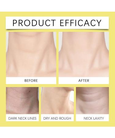  Generisch Anti Aging Firming Cream for Neck Firming Neck Cream with Collagen Vitamin C Hyaluronic Acid Reduce Wrinkles Moisturizes & Firms (1 Pack 150g) - Buy Online on GoSupps.com