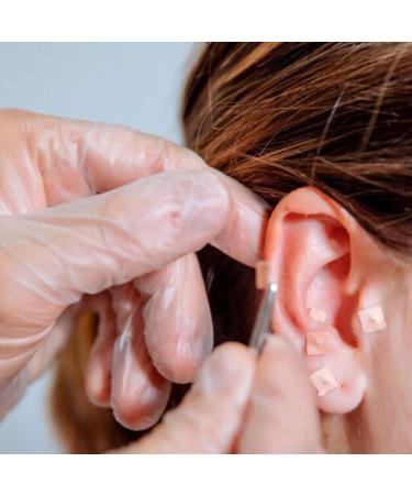 Buy 600 Piece Ear Acupuncture Set - Acupressure Stick Massage Pen & Tweezer for Holistic Healing - Buy Online on GoSupps.com