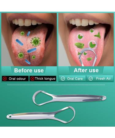 Premium Tongue Scraper Set - 2 Stainless Steel Scrapers & 10 Dental Floss Picks with Travel Case Cure Bad Breath & Enhance Oral Hygiene - Buy Online on GoSupps.com