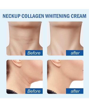 Neck Firming Cream Neck Firming Cream Collagen Neck Cream Anti Wrinkle Neck Cream Skin Tightening Cream Neck Neck Tightening Lifting Sagging Skin Anti Aging Neck Cream Anti Saggy Skin Neck Cream - Buy Online on GoSupps.com