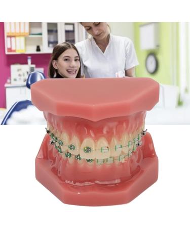 Orthodontic Demonstration Model & Bracket Model - Visualize Orthodontic Process | Worldwide Shipping - Buy Online on GoSupps.com