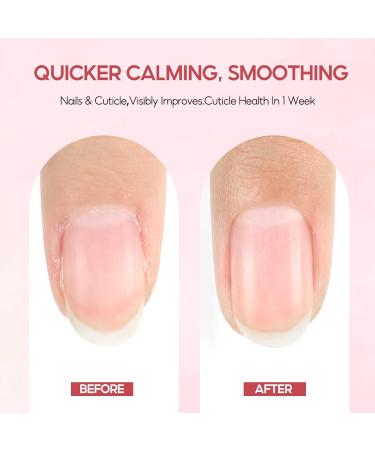 PEACECOLOR Huile Cuticules Ongles 8 pi ces Nail Cuticle oil Kit de Soin Naturel des Cuticules Huiles Huile de Soin des Cuticules Essentielles Ongles Lissante Nourrissante Hydratante 8 St ck Nagel l Stift - Buy Online on GoSupps.com
