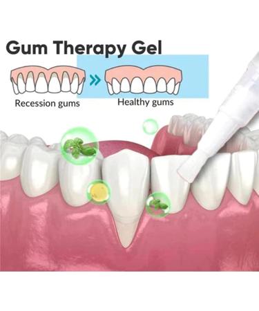 Taileden Gum Therapy Gel Gum Disease Treatment Pen Receding Gum Treatment Gel Teeth Whitening Pens Teeth Whitening Gel (Color : - Buy Online on GoSupps.com