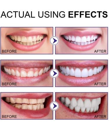 3 Days Teeth Whitening Powder Kit - Mint Flavors for Fresh Breath & Effective Cleaning (2PCs) | International Shipping Available - Buy Online on GoSupps.com