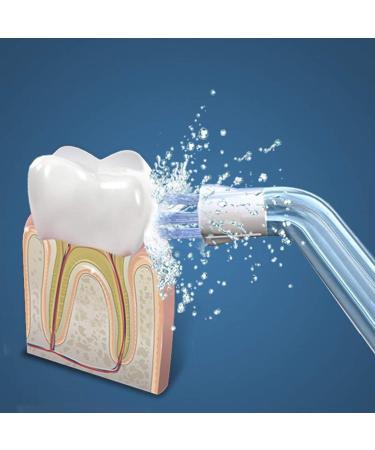 Plaque Seeker Replacement Tips - 4 Pack for Waterpik & Oral Irrigators - Buy Online on GoSupps.com