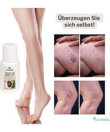 MEDOSAN Venen-Ex Roll-On for Varicose Veins | 75ml | Easy & Clean Application - Shop Internationally - Buy Online on GoSupps.com