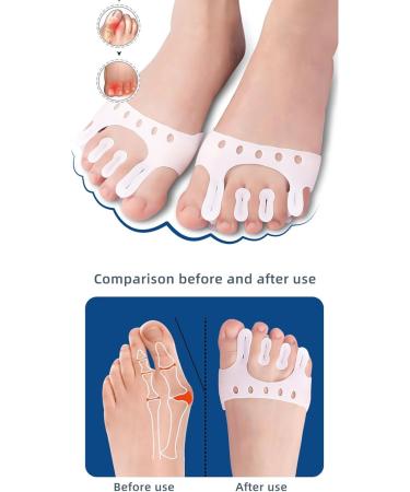 Hammer Toe Gel Spacers for Men and Women - Relief for Overlapping Toes, Bunions - Ideal for Running and Yoga - Buy Online on GoSupps.com