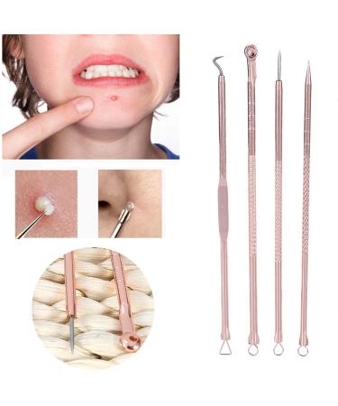 4-Piece Blackhead Remover Kit | Stainless Steel Acne Removal Tools & Comedon Extractor | Pimple Treatment Set - Buy Online on GoSupps.com