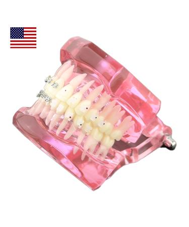 Buy Dental Orthodontic Teeth Model with Metal & Ceramic Brackets - Ideal for Study & Research | International Shipping Available - Buy Online on GoSupps.com