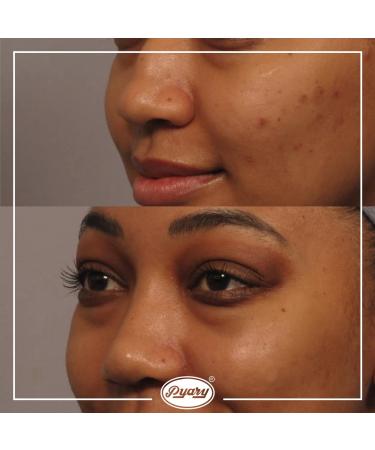 Organic Turmeric Soap - Handmade Vegan Ayurvedic 2.64 oz (Pack of 2) - Buy Online on GoSupps.com