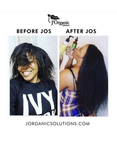 J Organic Solutions Super Healthy Hair Growth Set | Complete 5 Products for Thriving Hair - Shop Now for International Shipping - Buy Online on GoSupps.com