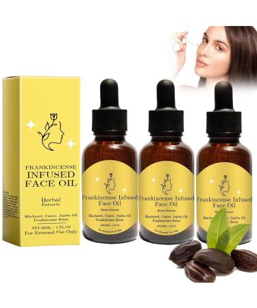 Frankincense Resin Oil For Face Frankincense Resin Infused Organic Black Seed Organic Black Seed Castor & Jojoba Oils Cold Pressed Serum Hydrates Skin Anti-Aging Wrinkle