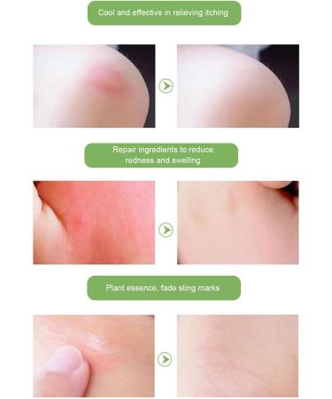  Rurunklee Anti-bite pencil | Natural anti-itch cream Anti-itch ointment for all skin types fast relief from itching bites and redness Rurunklee - Buy Online on GoSupps.com