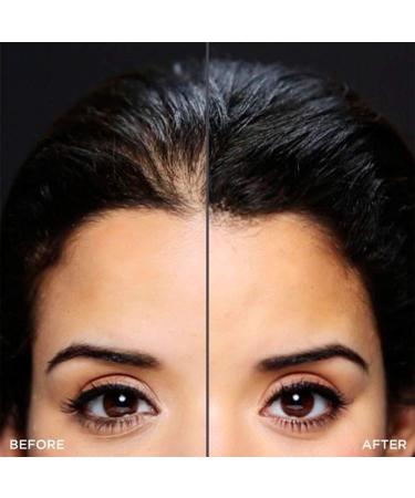 Toppik Hairline Optimizer - Buy 1 Pack for Fuller Hair | Best Hair Thinning Solution - Buy Online on GoSupps.com