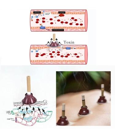 Jingling Moxibustion Burning Columns - 10 Slimming Sticks for Women | Energy Gathering & Weight Reduction - Buy Online on GoSupps.com